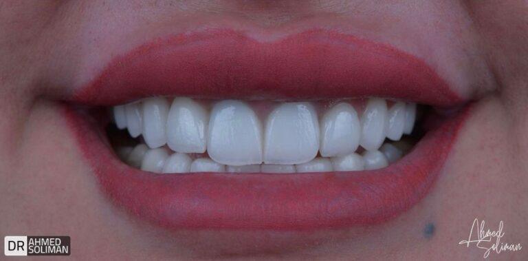 WhatsApp Image 2025-10-07 at 23.23