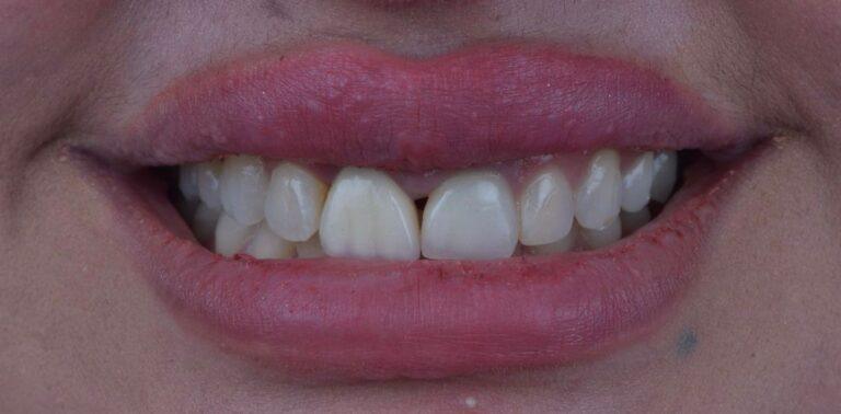 WhatsApp Image 2025-10-07 at 23.23